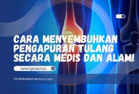 Cara Menyembuhkan Pengapuran Tulang Secara Medis dan Alami 